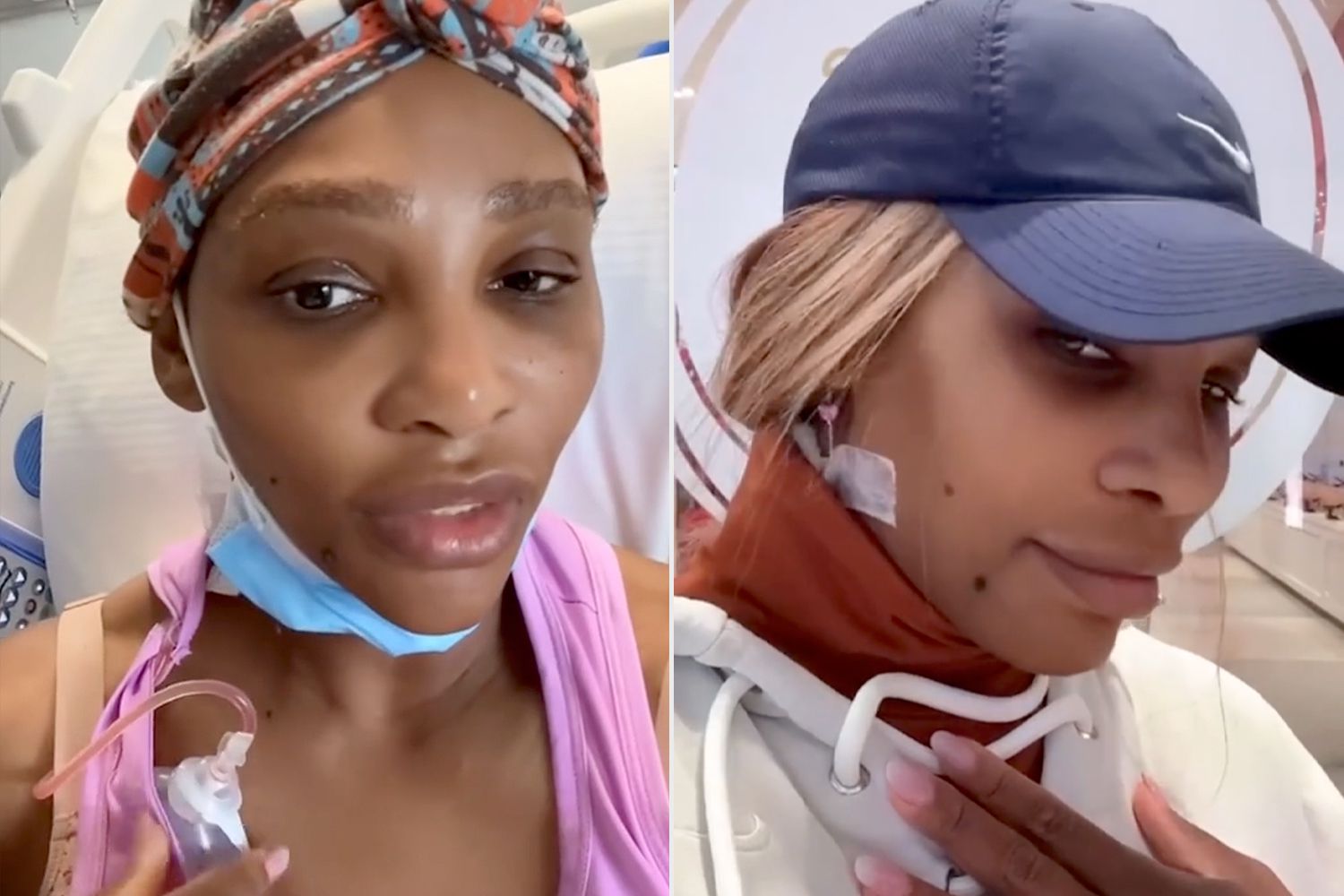 “Breaking: Serena’s doctors just removed a massive cyst from her neck – fans can’t stop praying for her speedy recovery. 🙏 Tag a friend who’d want to send good vibes!