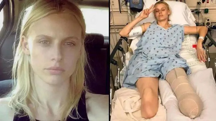 Tragedy strikes: American model loses legs and almost dies despite proper tampon use! …See More