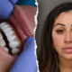 SHOCKING: Florida Woman Arrested For Unlicensed Dental Work Allegedly Used Superglue On Victims' Teeth And Infections...