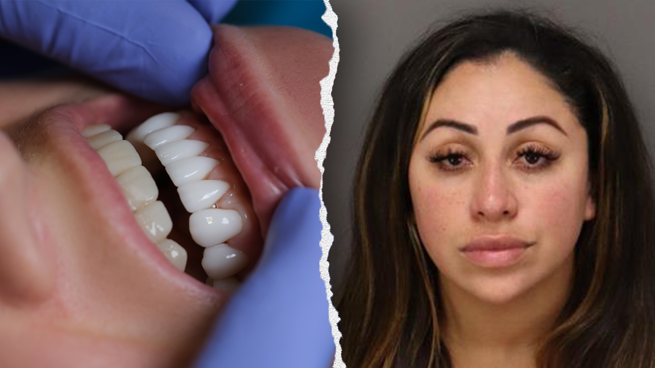 SHOCKING: Florida Woman Arrested For Unlicensed Dental Work Allegedly Used Superglue On Victims' Teeth And Infections...