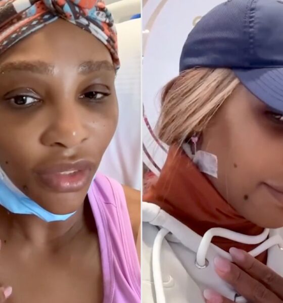“Breaking: Serena’s doctors just removed a massive cyst from her neck – fans can’t stop praying for her speedy recovery. 🙏 Tag a friend who’d want to send good vibes!